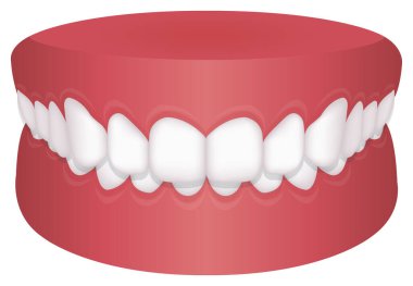 Diş sorunu (ısırık türü) vektör illüstrasyonu / derin ısırık