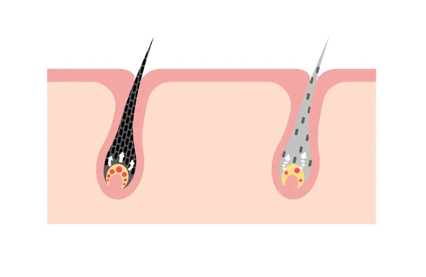 Mecanismo Cabelo Pigmentado Cabelo Grisalho Comparação Ilustração Vetorial Sem Texto —  Vetores de Stock