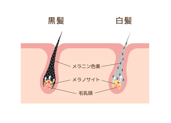 Mechanism Pigmented Hair Gray Hair Comparison Vector Illustration Japanese — Stock Vector