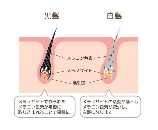 Mechanismus Von Pigmentierten Haaren Und Grauen Haaren Vergleichsvektorillustration Japanisch — Stockvektor
