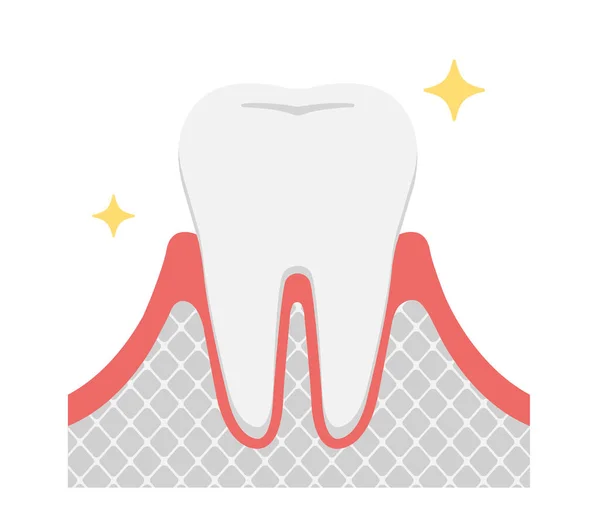 Szakaszok Periodontitis Betegség Egészséges Fog — Stock Vector