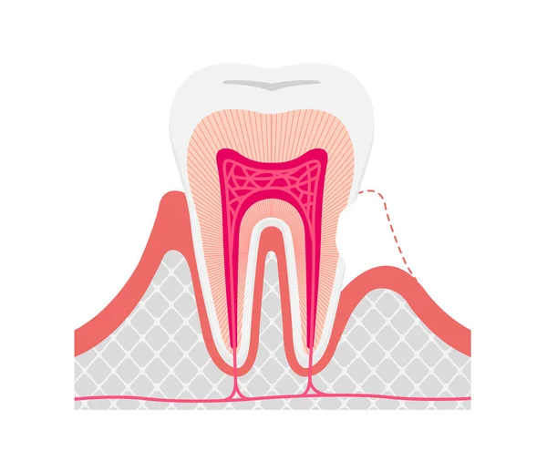 Cause Mécanisme Des Dents Sensibles Illustration Vectorielle Pas Texte — Image vectorielle