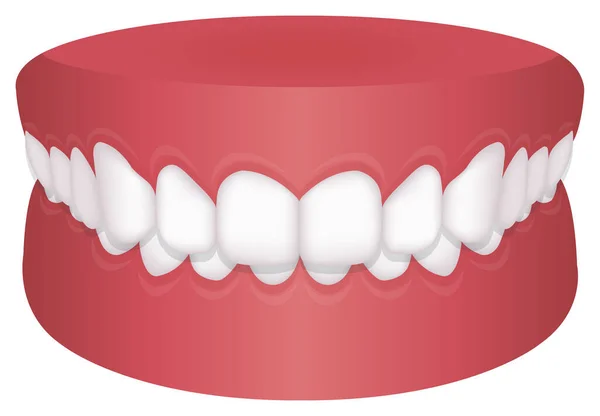 Problemi Denti Tipo Morso Illustrazione Vettoriale Morso Profondo — Vettoriale Stock