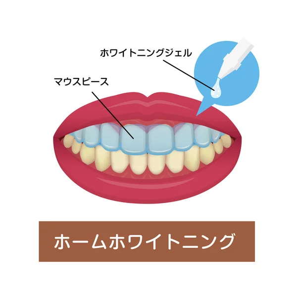 Clareamento Dos Dentes Ilustração Vetor Doméstico Japonês —  Vetores de Stock