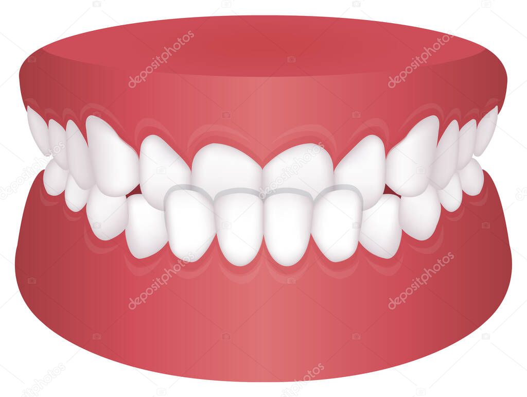 Teeth trouble ( bite type ) vector illustration /Underbite