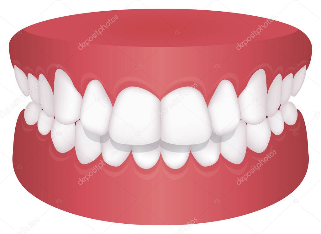 Teeth trouble ( bite type ) vector illustration /Overbite (Back teeth)