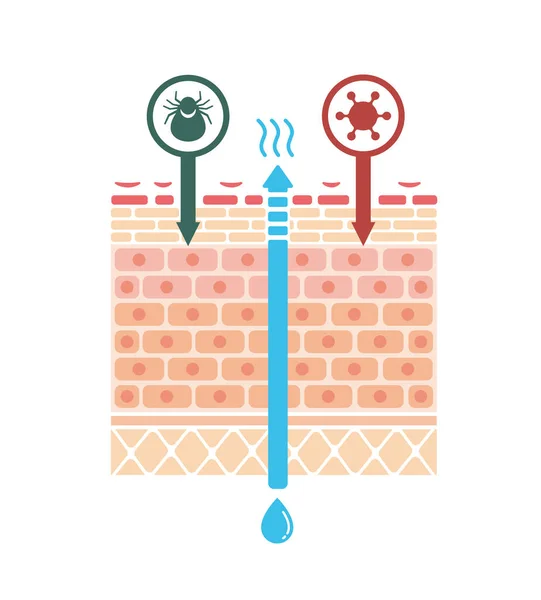 Atópiás Dermatitis Vektor Illusztráció Szekcionális Nézete Szöveg Nélkül — Stock Vector