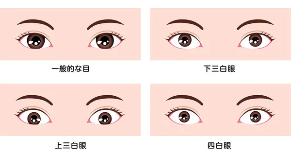各种眼形 不同的眼球大小和位置 矢量图解 亚洲的分类 — 图库矢量图片