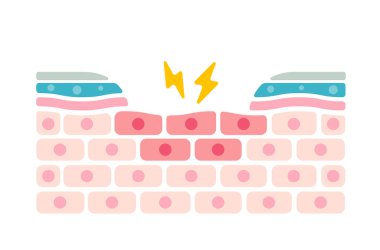 Kuru göz yüzeyinin çapraz kesimi. düz vektör çizimi (metin yok)