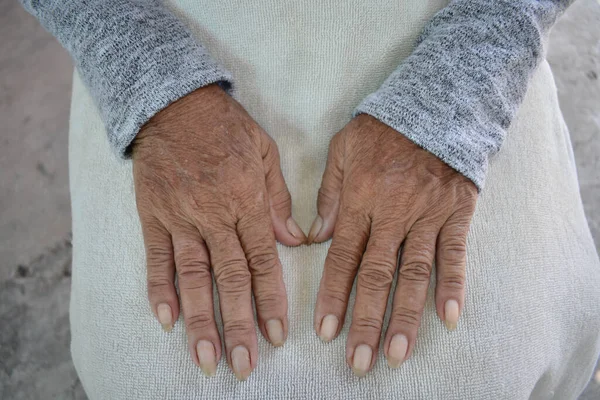 The hand of the sick old woman rests on the lap. Mental health care at home.