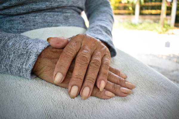 病人の老婦人の手は膝の上にある 自宅での精神保健医療 — ストック写真