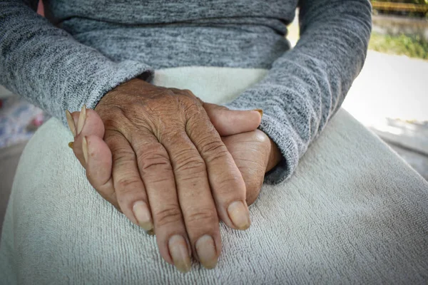 Ręka Chorej Staruszki Spoczywa Kolanach Opieka Zdrowotna Domu — Zdjęcie stockowe