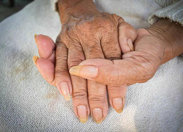 Dłoń Chorej Staruszki Spoczywa Kolanach Opieka Zdrowotna Domu — Zdjęcie stockowe