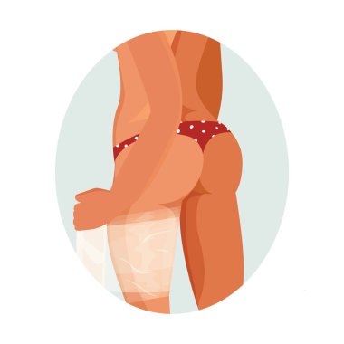 Zayıflatma, yağ yakma ve selülit tedavisi konsepti. Bacakları için plastik vücut sargısı yapan bir kız. Düz biçimde izole edilmiş vektör illüstrasyonu