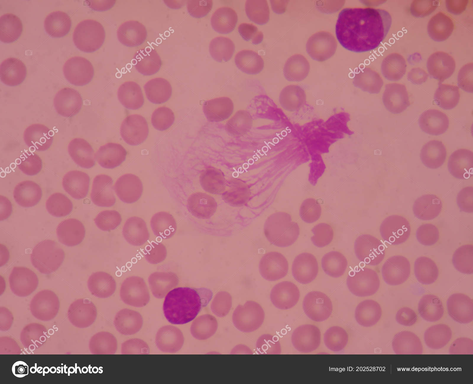 Basket Cell Red Blood Cells Background Medical Science Concept Stock