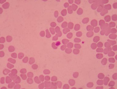 Kırmızı kan hücrelerinin arka plan büyük trombosit kan yayma.