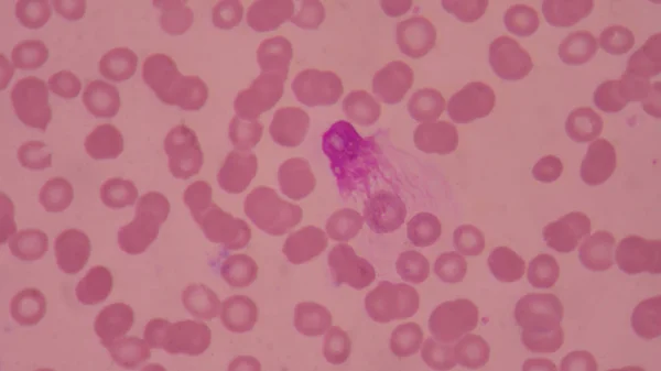 Célula Cesta Células Vermelhas Sangue Fundo Conceito Ciência Médica — Fotografia de Stock