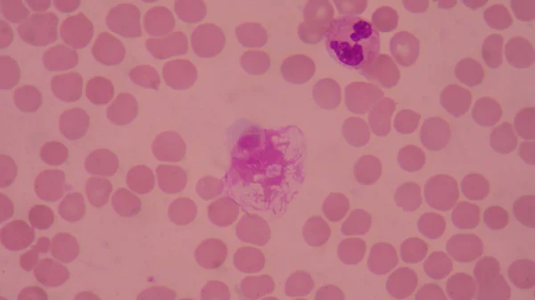 Korg Cellen Röda Blodkroppar Bakgrund Medicinsk Vetenskap Koncept — Stockfoto