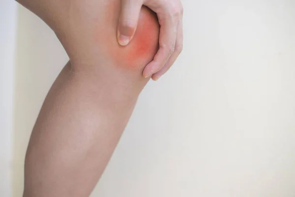 Arthritis Kniegelenk Verletzt Und Schmerzen — Stockfoto