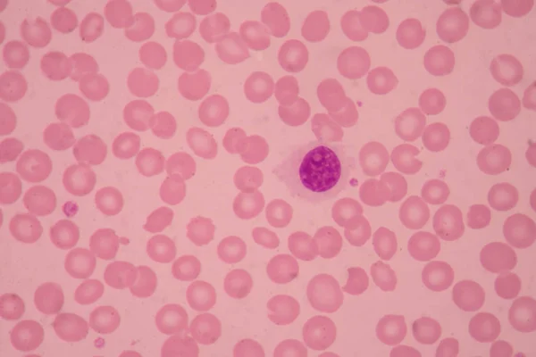 正常な赤い血液細胞医療の背景 — ストック写真