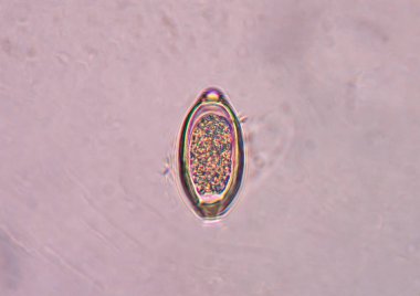 Trichuris trichiura parazit dışkı sınavı.