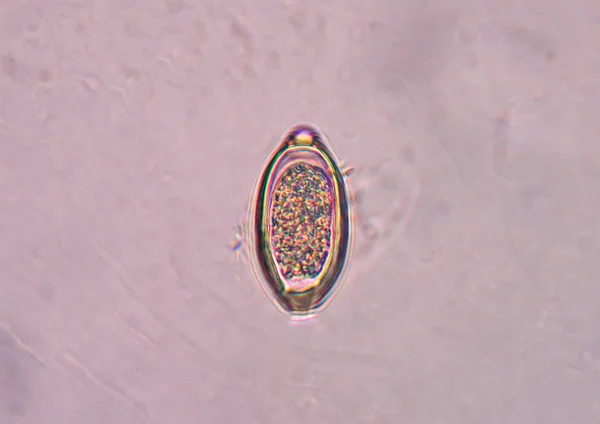 시험에서 Trichuris Trichiura 기생충 — 스톡 사진