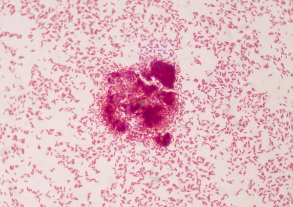 Las Bacterias Intracelulares Glóbulos Rojos Gramtinción Encuentran Con Microscopio — Foto de Stock