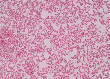 Gram boyama, Gram'ın yöntemi, olarak da bilinir, iki büyük gruba (gram-pozitif ve gram-negatif bakteri ayırt bir yöntemdir).