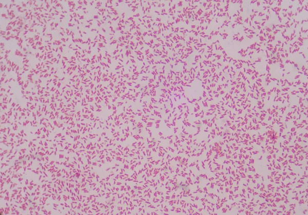 Mérsékelt Grem Neagtive Bacilusok Medicl Tudomány Cept — Stock Fotó