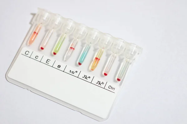 Grupo Sanguíneo Tpyping Testing Gel Test —  Fotos de Stock