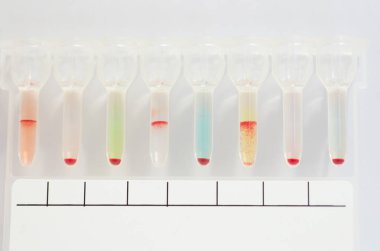 Kan grubu Abo yazarak jel test.