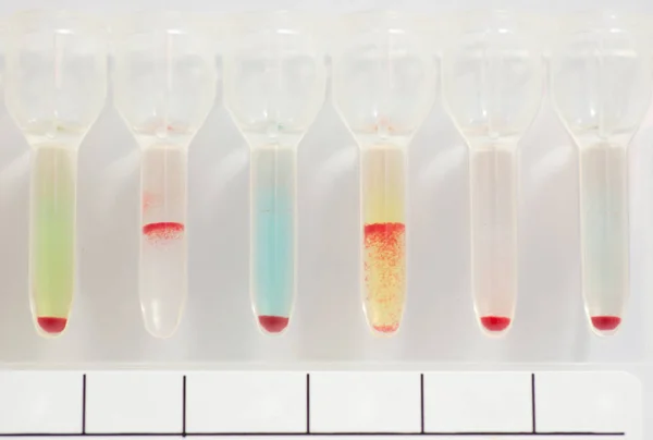 Grupo sanguíneo teste de gel de tipagem ABO . — Fotografia de Stock