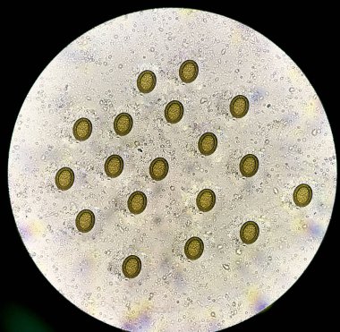 Taenia eggs in stool find with microscope. clipart