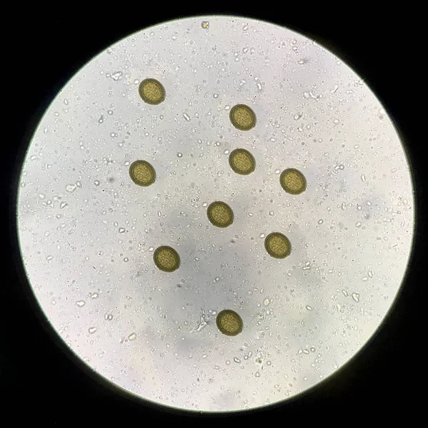 Taenia ovos nas fezes encontrar com microscópio . — Fotografia de Stock