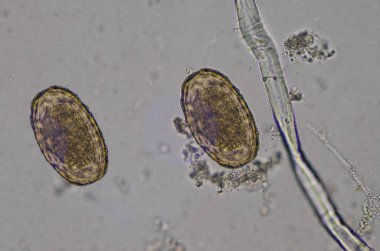 Parasite egg Ascaris lumbricoides find with microscope. clipart