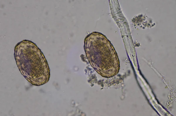 Uovo di parassita Ascaris lumbricoides trovare con microscopio . — Foto Stock