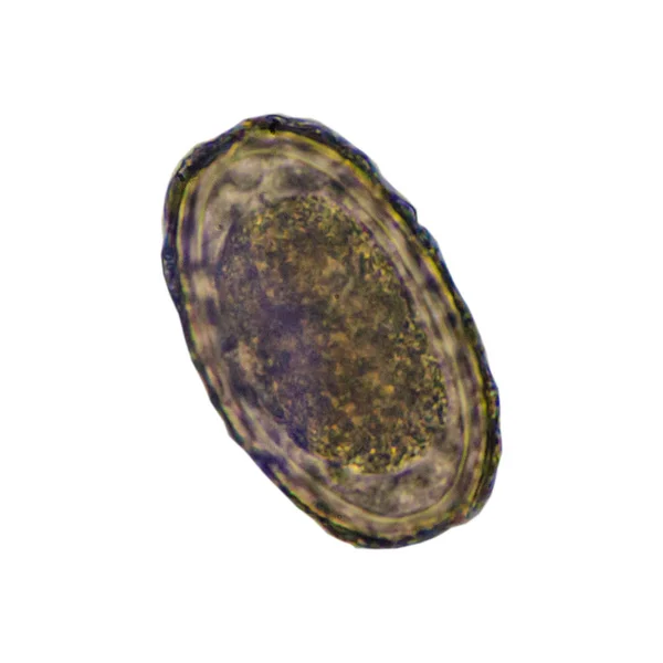 Telur parasit Ascaris lumbricoides ditemukan dengan mikroskop . — Stok Foto