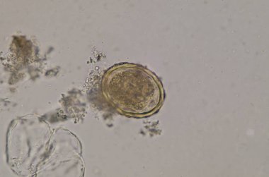 Bağısak solucanı yumurta dışkı sınavı.