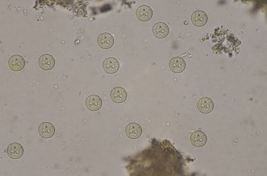 Dışkı muayenesinde Entamoeba coli kistleri evresi.