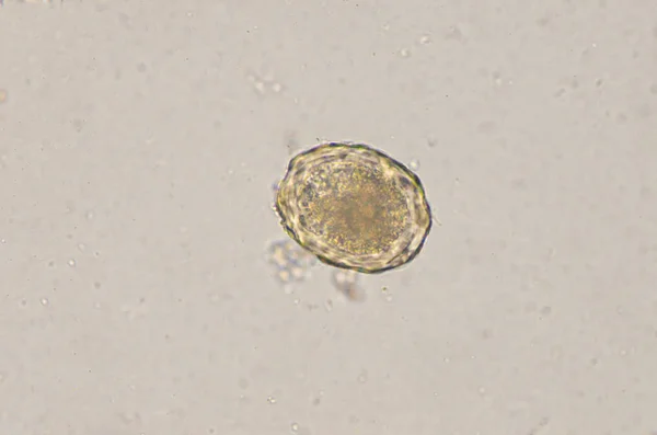 Ascaris lumbricoides αυγό σε εξέταση κοπράνων. — Φωτογραφία Αρχείου
