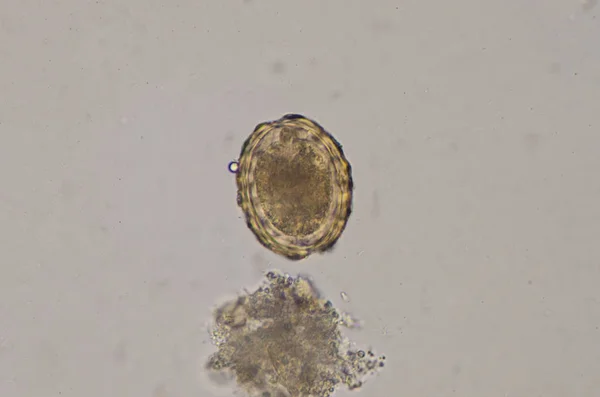 Ascaris lumbricoides huevo en el examen de heces . —  Fotos de Stock