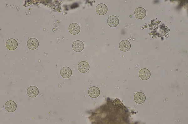 Entamoeba coli cysten stage in ontlasting examen. — Stockfoto