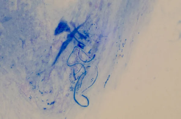 Pseudohyphae en método de la mancha del gramo . — Foto de Stock