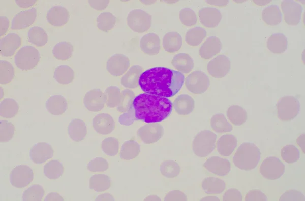 Blast celler på röda blodkroppar bakgrund. — Stockfoto