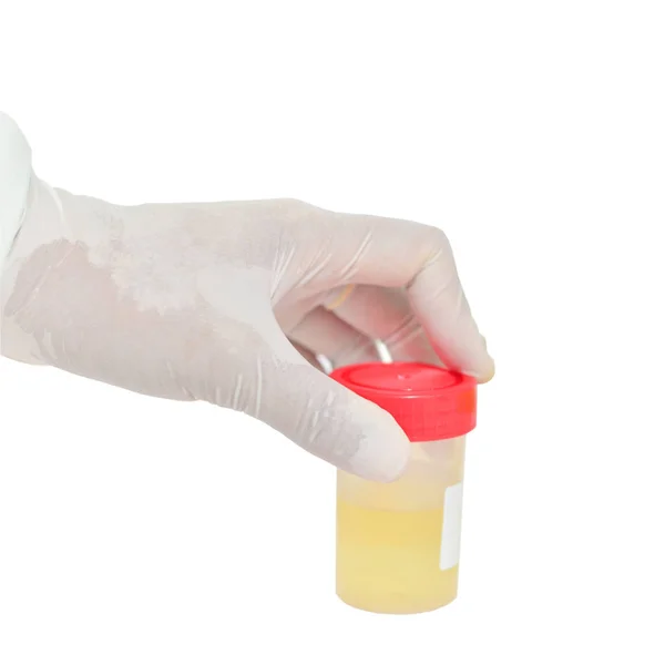 Mão segurando fundo de urina no fundo branco . — Fotografia de Stock