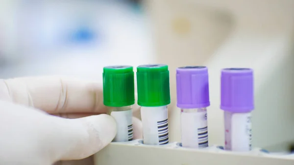 EDTA tube à essai violet effectuer le test de numération sanguine et l'hépatite au lithium — Photo