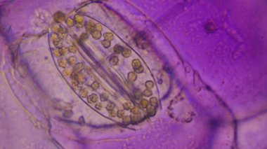 Tradescantia spathacea stomata kadar yakın.