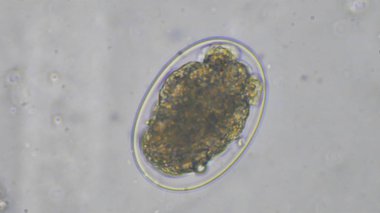 Dışkı muayenesinde Makro Hookworm yumurta paraziti.