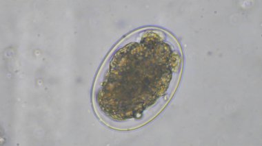 Macro Hookworm eggs parasite in stool examination. clipart