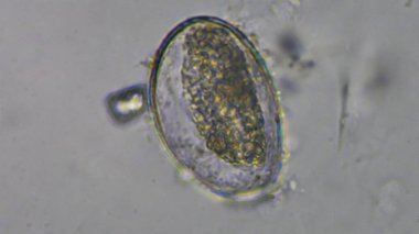 Dışkı muayenesinde makro Gnathostoma spinigerum yumurta.